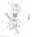 Fig. 05 - Method and apparatus for treating malocclusions and teeth alignment