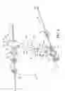 Fig. 07 - Method and apparatus for treating malocclusions and teeth alignment