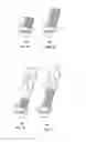 Fig. 06 - Molds for custom dental implant abutments and impression posts