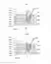 Fig. 13 - Molds for custom dental implant abutments and impression posts