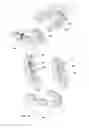 Fig. 17 - Molds for custom dental implant abutments and impression posts