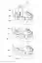 Fig. 19 - Molds for custom dental implant abutments and impression posts