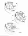 Fig. 28 - Molds for custom dental implant abutments and impression posts