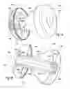 Fig. 10 - Female urinary incontinence device