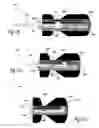 Fig. 16 - Female urinary incontinence device