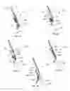 Fig. 05 - Visual stabilizer on anchor legs of vena cava filter
