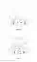Fig. 10 - Fork-type covered stent