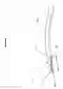 Fig. 04 - CORNEAL IMPLANT INSERTERS AND METHODS OF USE