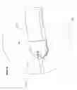 Fig. 07 - CORNEAL IMPLANT INSERTERS AND METHODS OF USE