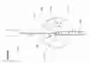 Fig. 08 - CORNEAL IMPLANT INSERTERS AND METHODS OF USE