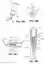 Fig. 22 - CORNEAL IMPLANT INSERTERS AND METHODS OF USE