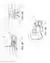 Fig. 04 - Process of manufacturing a heart valve made of a polymeric material and the heart valve thereby obtained