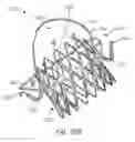Fig. 09 - Mitral valve prosthesis