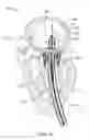 Fig. 15 - Mitral valve prosthesis