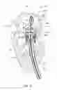Fig. 16 - Mitral valve prosthesis