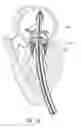 Fig. 25 - Mitral valve prosthesis