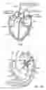 Fig. 02 - Prosthetic heart valve devices and associated systems and methods