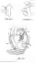 Fig. 04 - Prosthetic heart valve devices and associated systems and methods
