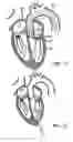 Fig. 07 - Prosthetic heart valve devices and associated systems and methods