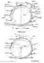 Fig. 10 - Prosthetic heart valve devices and associated systems and methods