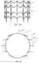 Fig. 30 - Prosthetic heart valve devices and associated systems and methods