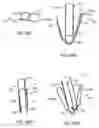 Fig. 37 - Prosthetic heart valve devices and associated systems and methods