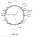 Fig. 40 - Prosthetic heart valve devices and associated systems and methods