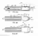 Fig. 41 - Prosthetic heart valve devices and associated systems and methods