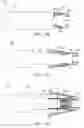 Fig. 46 - Prosthetic heart valve devices and associated systems and methods