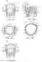 Fig. 47 - Prosthetic heart valve devices and associated systems and methods