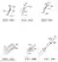 Fig. 48 - Prosthetic heart valve devices and associated systems and methods