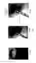 Fig. 04 - Devices, systems and methods for repairing lumenal systems