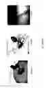 Fig. 05 - Devices, systems and methods for repairing lumenal systems