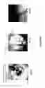 Fig. 06 - Devices, systems and methods for repairing lumenal systems