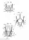 Fig. 05 - Valve suturing and implantation procedures