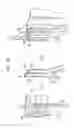 Fig. 10 - Valve suturing and implantation procedures