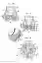Fig. 15 - Valve suturing and implantation procedures