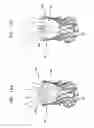 Fig. 20 - Valve suturing and implantation procedures