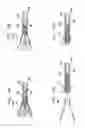 Fig. 24 - Valve suturing and implantation procedures