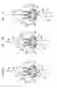 Fig. 28 - Valve suturing and implantation procedures