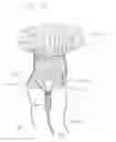 Fig. 05 - Prosthetic heart valve and systems and methods for delivering the same