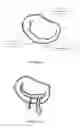 Fig. 02 - METHOD AND APPARATUS FOR MITRAL VALVE ANNULOPLASTY