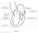 Fig. 03 - METHOD AND APPARATUS FOR MITRAL VALVE ANNULOPLASTY