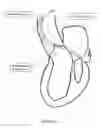 Fig. 08 - METHOD AND APPARATUS FOR MITRAL VALVE ANNULOPLASTY