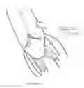 Fig. 09 - METHOD AND APPARATUS FOR MITRAL VALVE ANNULOPLASTY