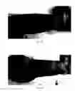 Fig. 06 - System and method for nonsurgical penile girth enhancement