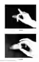 Fig. 07 - System and method for nonsurgical penile girth enhancement