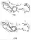 Fig. 02 - Prostheses and methods for acetabular rim restoration in quadruped mammals