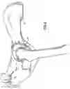 Fig. 03 - Prostheses and methods for acetabular rim restoration in quadruped mammals