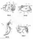 Fig. 04 - Prostheses and methods for acetabular rim restoration in quadruped mammals